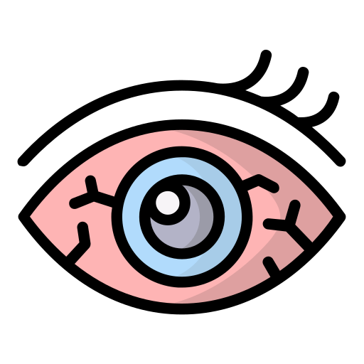Redness and irritation of the eyes eye refraction assessment