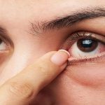 Dry Eye Symptoms